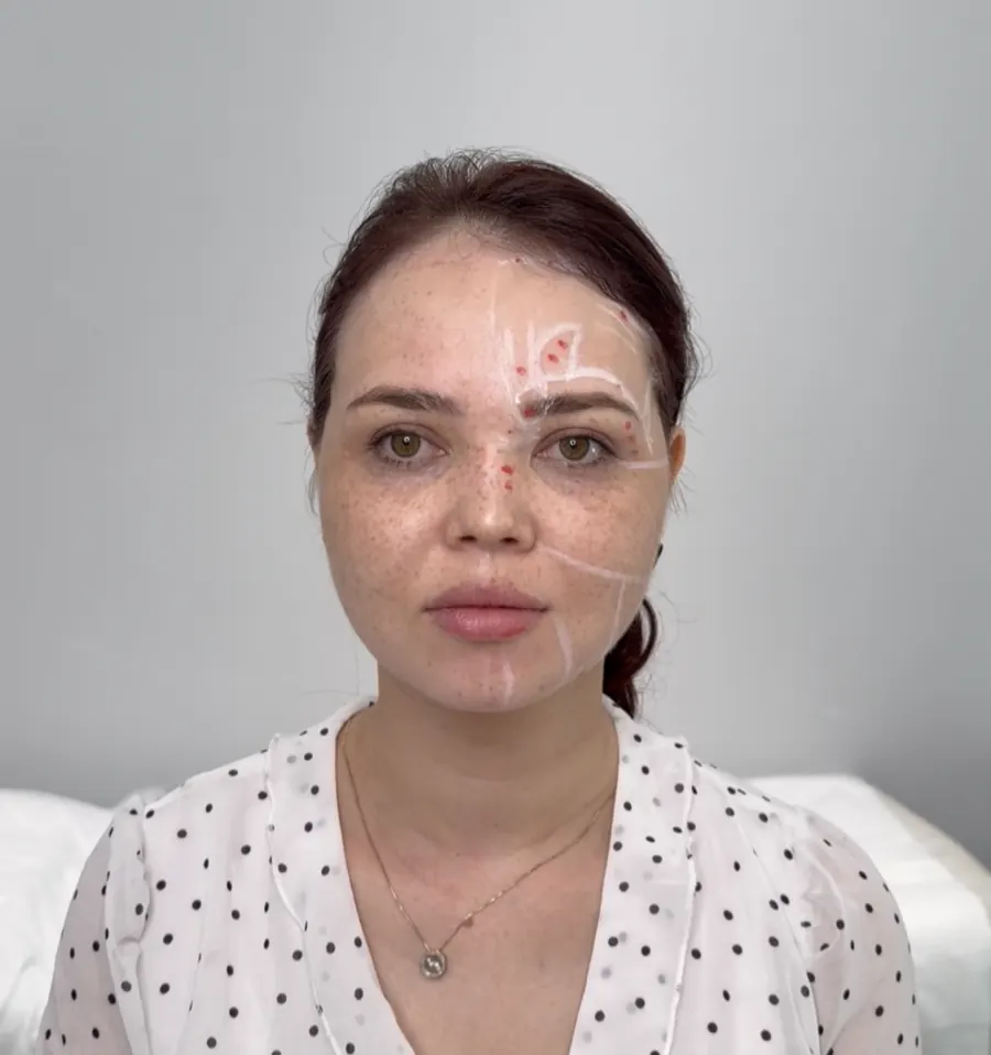 Mimik proba paytidagi razmetka